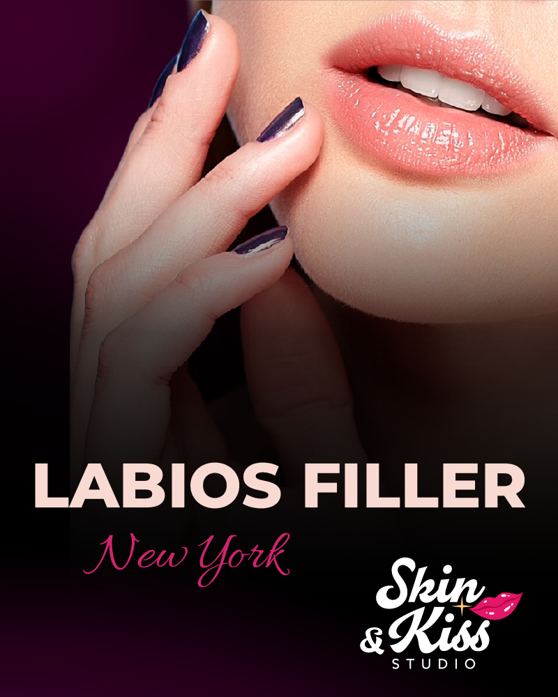 Labios filler