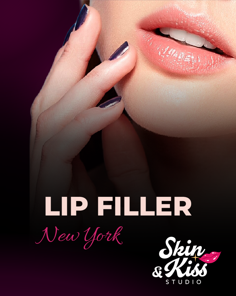 Lip filler