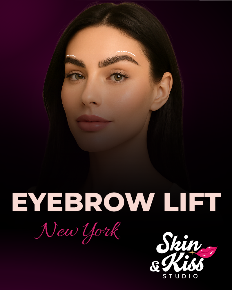 Eyebrow lift