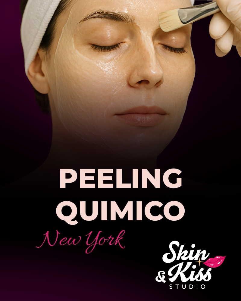 Peeling químico